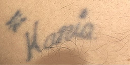 Tatuaje en eliminación láser en Ink Fire, Mazatlán, antes