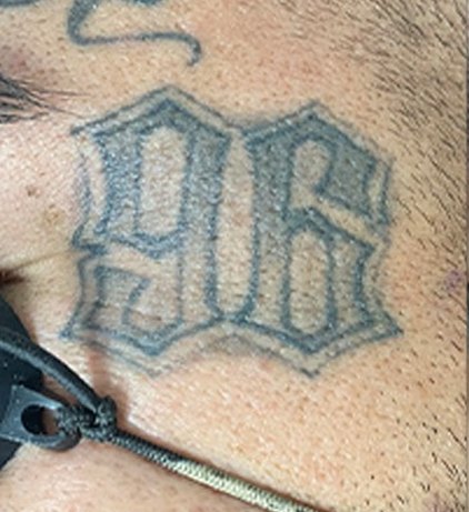 Tatuaje en eliminación láser en Ink Fire, Mazatlán, antes