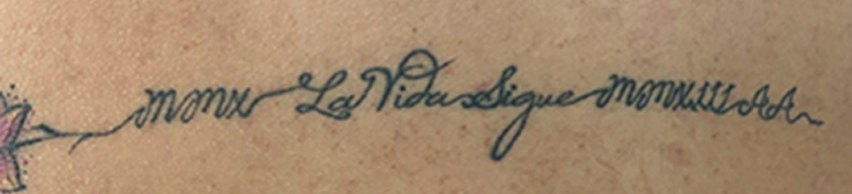 Tatuaje en eliminación láser en Ink Fire, Mazatlán, antes