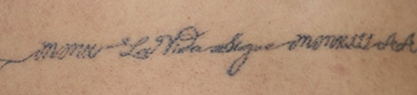 Tatuaje en eliminación láser en Ink Fire, Mazatlán, después de las sesiones