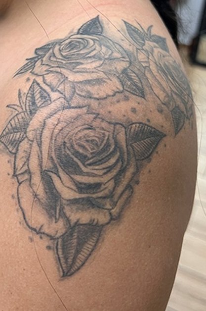 Tatuaje en eliminación láser en Ink Fire, Mazatlán, antes