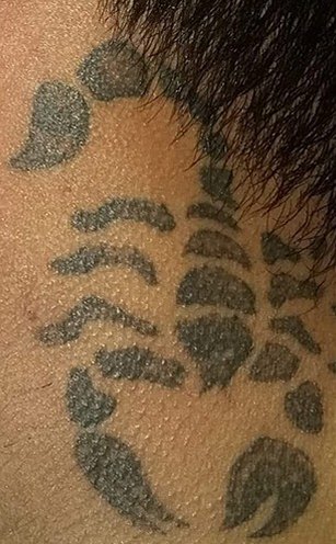 Tatuaje en eliminación láser en Ink Fire, Mazatlán, antes