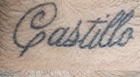 Tatuaje en eliminación láser en Ink Fire, Mazatlán, antes